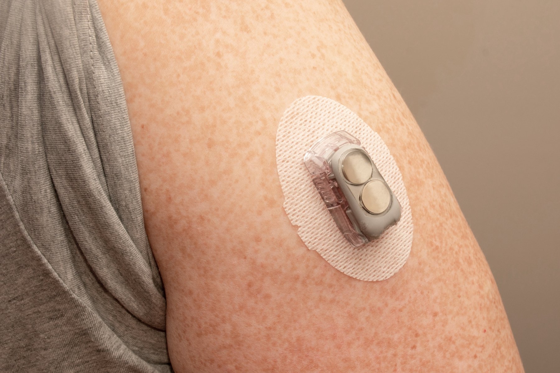 Person wearing a Contact Glucose Monitor (CGM)
